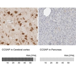 CSAP Antibody, Novus Biologicals:Antibodies:Primary Antibodies